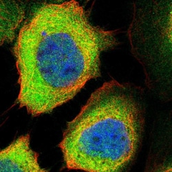 Invitrogen PPM1L Polyclonal Antibody 100 &mu;L; Unconjugated:Antibodies,