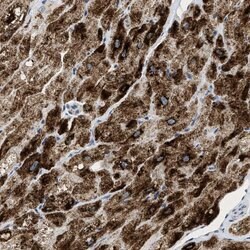 Invitrogen PPM1L Polyclonal Antibody 100 &mu;L; Unconjugated:Antibodies,