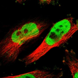 Invitrogen RAD21 Polyclonal Antibody 100 &mu;L; Unconjugated:Antibodies,