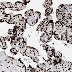 Invitrogen RAD21 Polyclonal Antibody 100 &mu;L; Unconjugated:Antibodies,