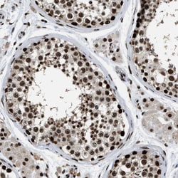 Invitrogen RAD21 Polyclonal Antibody 100 &mu;L; Unconjugated:Antibodies,