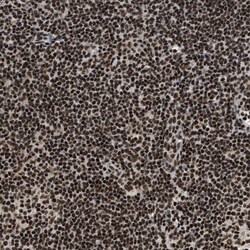 Invitrogen RAD21 Polyclonal Antibody 100 &mu;L; Unconjugated:Antibodies,
