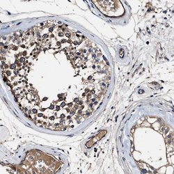 Invitrogen IFT81 Polyclonal Antibody 100 μL; Unconjugated:Antibodies,