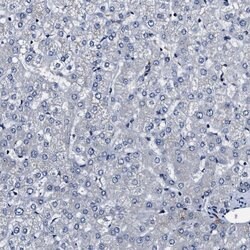 Invitrogen IFT81 Polyclonal Antibody 100 μL; Unconjugated:Antibodies,