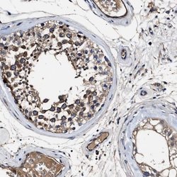 Invitrogen IFT81 Polyclonal Antibody 100 μL; Unconjugated:Antibodies,