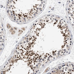 Invitrogen CCDC146 Polyclonal Antibody 100 &mu;L; Unconjugated:Antibodies,