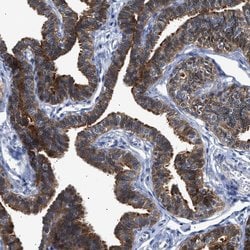 Invitrogen CCDC146 Polyclonal Antibody 100 &mu;L; Unconjugated:Antibodies,