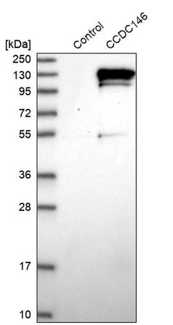 Invitrogen CCDC146 Polyclonal Antibody 100 &mu;L; Unconjugated:Antibodies,