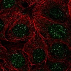 Invitrogen ZNF425 Polyclonal Antibody 100 &mu;L | Buy Online | Invitrogen&trade; | Fisher Scientific