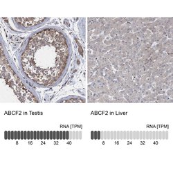 Invitrogen ABCF2 Polyclonal Antibody 100 &mu;L | Buy Online | Invitrogen&trade; | Fisher Scientific