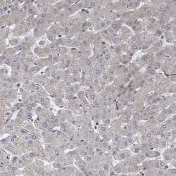 Invitrogen ABCF2 Polyclonal Antibody 100 &mu;L | Buy Online | Invitrogen&trade; | Fisher Scientific