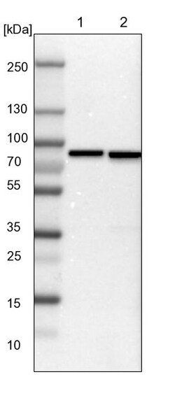 Invitrogen ABCF2 Polyclonal Antibody 100 &mu;L | Buy Online | Invitrogen&trade; | Fisher Scientific