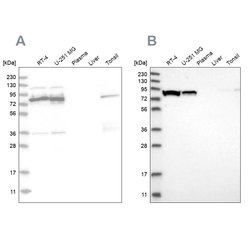 Invitrogen ABCF2 Polyclonal Antibody 100 &mu;L | Buy Online | Invitrogen&trade; | Fisher Scientific