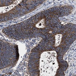 Invitrogen MACC1 Polyclonal Antibody 100 &mu;L; Unconjugated:Antibodies,