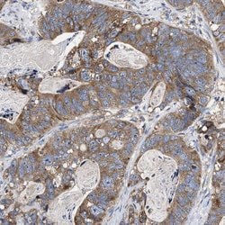 Invitrogen MACC1 Polyclonal Antibody 100 &mu;L; Unconjugated:Antibodies,