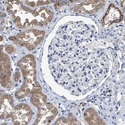Invitrogen MACC1 Polyclonal Antibody 100 &mu;L; Unconjugated:Antibodies,
