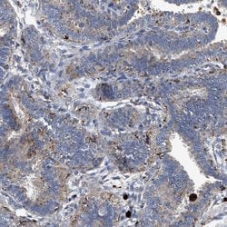 Invitrogen CCDC146 Polyclonal Antibody 100 &mu;L; Unconjugated:Antibodies,