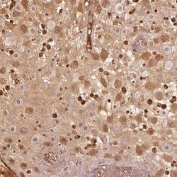 Invitrogen PAEP Polyclonal Antibody 100 &mu;L; Unconjugated:Antibodies,