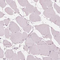 Invitrogen PAEP Polyclonal Antibody 100 &mu;L; Unconjugated:Antibodies,