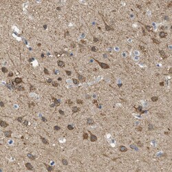 Invitrogen KLHDC10 Polyclonal Antibody 100 &mu;L; Unconjugated:Antibodies,
