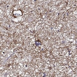Invitrogen DDX25 Polyclonal Antibody 100 &mu;L; Unconjugated:Antibodies,