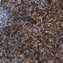 Invitrogen GIMA7 Polyclonal Antibody 100 &mu;L | Buy Online | Invitrogen&trade; | Fisher Scientific