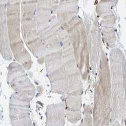Invitrogen GIMA7 Polyclonal Antibody 100 &mu;L | Buy Online | Invitrogen&trade; | Fisher Scientific