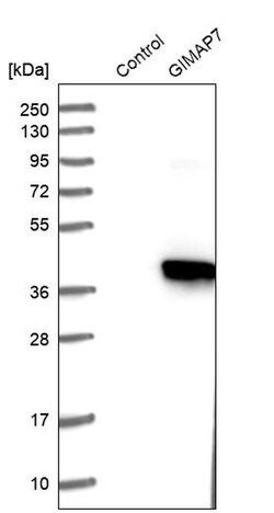 Invitrogen GIMA7 Polyclonal Antibody 100 &mu;L | Buy Online | Invitrogen&trade; | Fisher Scientific