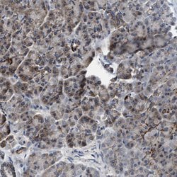 Invitrogen CCM2 Polyclonal Antibody 100 &mu;L; Unconjugated:Antibodies,