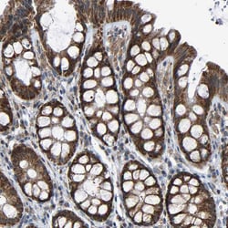 Invitrogen SLIRP Polyclonal Antibody 100 &mu;L; Unconjugated:Antibodies,
