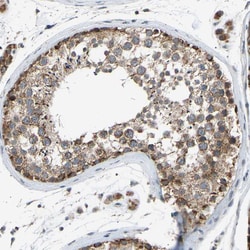 Invitrogen SLIRP Polyclonal Antibody 100 &mu;L; Unconjugated:Antibodies,