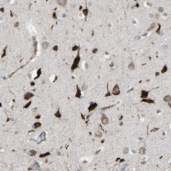 Invitrogen VPS41 Polyclonal Antibody 100 &mu;L; Unconjugated:Antibodies,