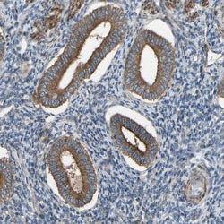 Invitrogen VPS41 Polyclonal Antibody 100 &mu;L; Unconjugated:Antibodies,