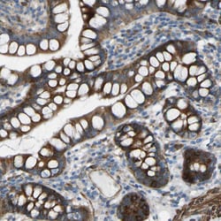 Invitrogen VPS41 Polyclonal Antibody 100 &mu;L; Unconjugated:Antibodies,