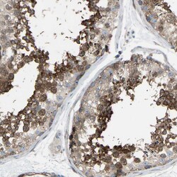 Invitrogen VPS41 Polyclonal Antibody 100 &mu;L; Unconjugated:Antibodies,