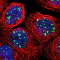 Invitrogen RRP1B Polyclonal Antibody 100 &mu;L; Unconjugated:Antibodies