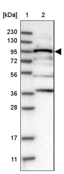 Invitrogen RRP1B Polyclonal Antibody 100 &mu;L; Unconjugated:Antibodies