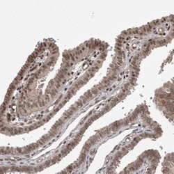Invitrogen ZNF592 Polyclonal Antibody 100 &mu;L; Unconjugated:Antibodies,