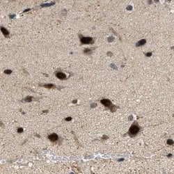 Invitrogen LARP6 Polyclonal Antibody 100 &mu;L; Unconjugated:Antibodies,