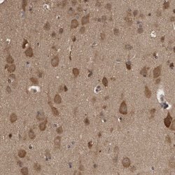 Invitrogen Ataxin 2 Polyclonal Antibody 100 &mu;L; Unconjugated:Antibodies,