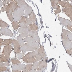 Invitrogen Ataxin 2 Polyclonal Antibody 100 &mu;L; Unconjugated:Antibodies,