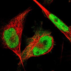Invitrogen CWC27 Polyclonal Antibody 100 &mu;L; Unconjugated:Antibodies,