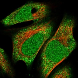 Invitrogen METT10D Polyclonal Antibody 100 &mu;L; Unconjugated:Antibodies,