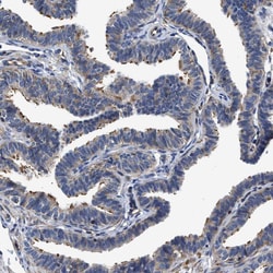Invitrogen TSPAN33 Polyclonal Antibody 100 &mu;L; Unconjugated:Antibodies,