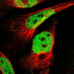 Invitrogen INIP Polyclonal Antibody 100 &mu;L; Unconjugated:Antibodies,