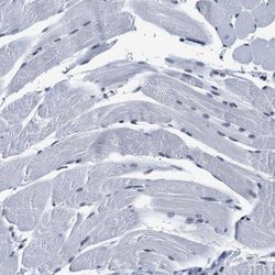 Invitrogen INIP Polyclonal Antibody 100 &mu;L; Unconjugated:Antibodies,