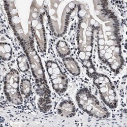 Invitrogen INIP Polyclonal Antibody 100 &mu;L; Unconjugated:Antibodies,