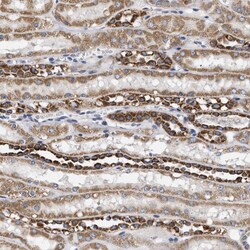 Invitrogen TMEM168 Polyclonal Antibody 100 &mu;L; Unconjugated:Antibodies,