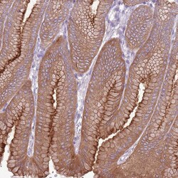 Invitrogen Calpain 9 Polyclonal Antibody 100 &mu;L; Unconjugated:Antibodies,