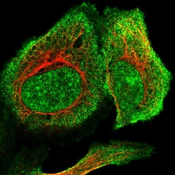 Invitrogen RSBN1L Polyclonal Antibody 100 &mu;L; Unconjugated:Antibodies,
